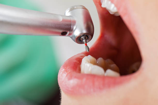Best Emergency Dentist for Knocked-Out Tooth in Copeland, OK